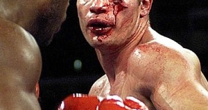 Worst boxing injuries of All Time